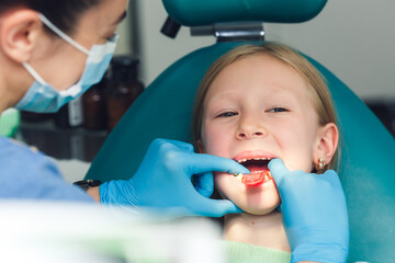 the dentist makes a jaw shape to take an impression of the patient's teeth.