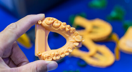 Dental technician modeling teeth frame for implant production from a 3d printer at the laboratory