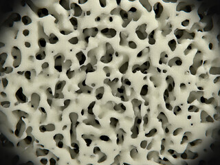 Healthy bone tissue