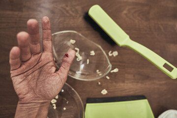 Selective focus on a cut female finger on the background of a split cup and a brush with a dustpan for cleaning. A wound with blood received when cleaning broken dishes. High quality photo