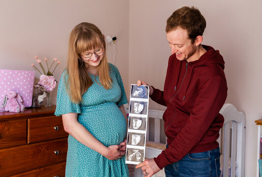 Happy young couple in their twenties holding ultrasound picture strip of baby