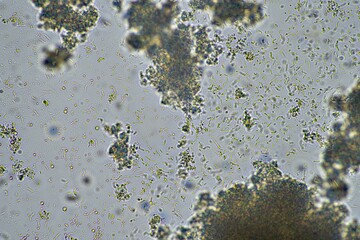 Yogurt under the microscope. Looking at lactobacillus bacteria in a healthy gut biome.