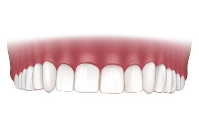 Realistic correct human upper jaw. Human jaw isolated on white background. Dental care concept.