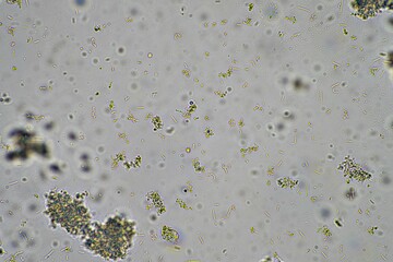 Yogurt under the microscope. Looking at lactobacillus bacteria in a healthy gut biome.