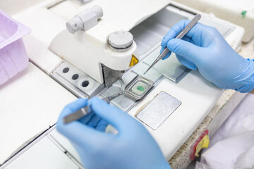 Scientist wearing blue gloves Biopsy blocks are being prepared for processing in the laboratory.