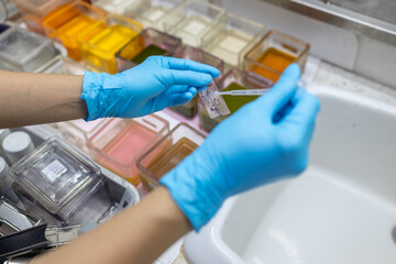 Scientists are preparing slides cytology or pathology for the pathologist to diagnose the disease in the operating room of the hospital such as dyeing, mounting