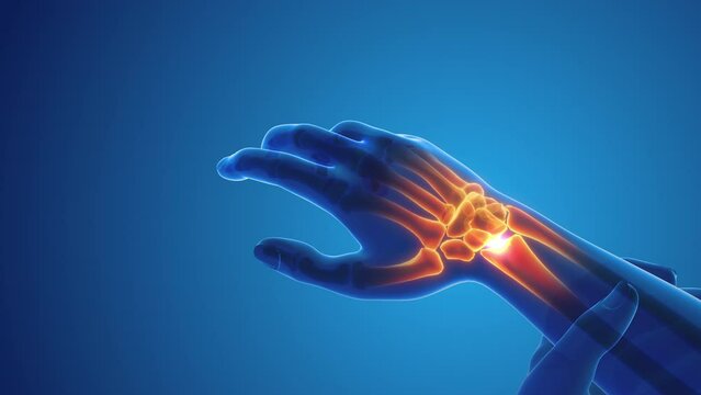 Pain in the wrist joint