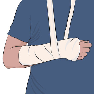 Young man with arm in a cast and bandaged. White background.