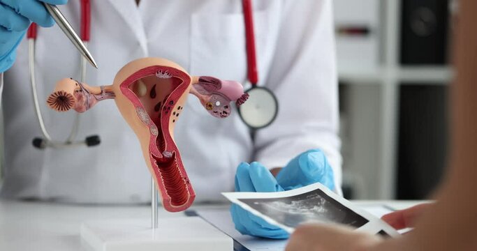 Gynecologist demonstrates model of female reproductive system to woman in clinic