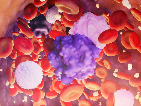 Blood cells with circulating tumor cells, illustration