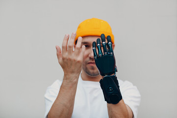Young disabled man checking and looking on artificial prosthetic hand and compare with healthy hand