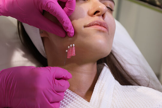 Close up face of thread lifting procedure. Professional cosmetologist in pink medical gloves inserting needles in chin scin. Anti-aging treatment and face lift in cosmetology clinic. Pretty woman fac