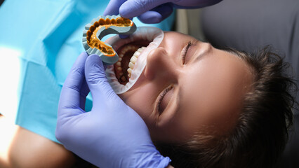 Simulation of artificial teeth on plaster model and patient with open mouth at dentist appointment