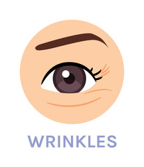 Wrinkles Around the Eye. Skin Problem. Tired Eye. Close up of Eye. Color Cartoon Style. White background. Vector illustration for Beauty and Cosmetic Design.