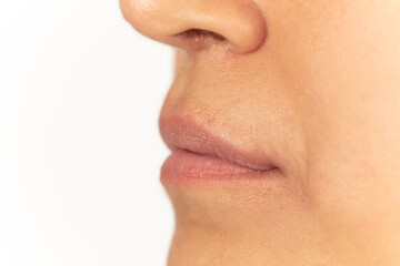 Close-up of female lips on white background before lip augmentation.
