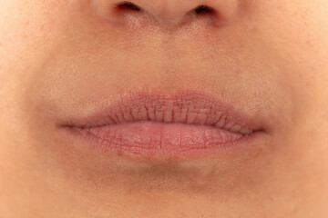 Close-up of female lips on white background before lip augmentation.
