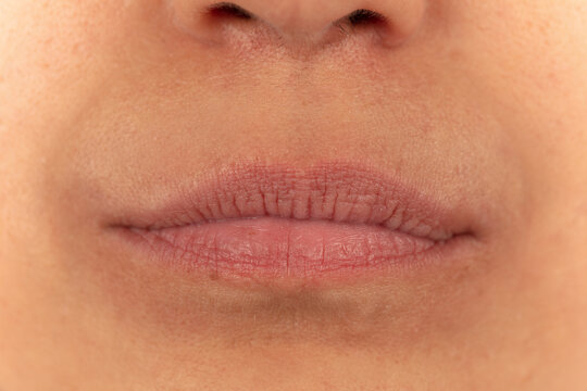 Close-up of female lips on white background before lip augmentation.
