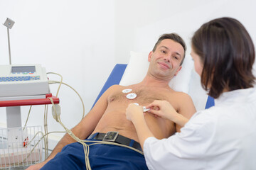 cardiac stress test ecg tracings