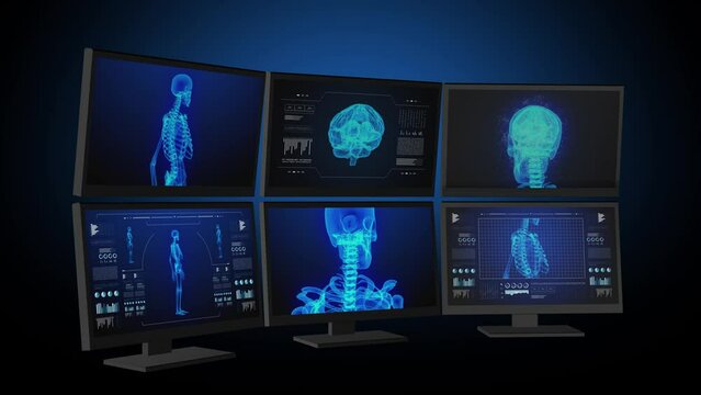 Medical computers workstation. Animated infographics. 3d images.