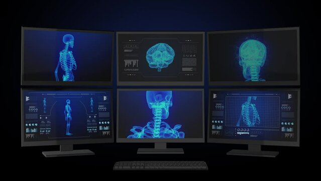 Medical computers workstation. Animated infographics. 3d images.