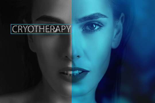 Face and skin of a woman close-up after cold therapy, Cryotherapy Skincare