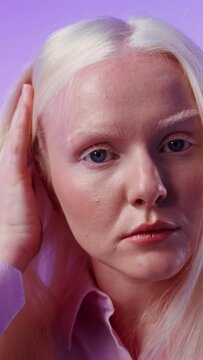 Young albino woman posing against a plain background, vertical video