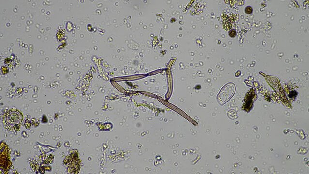microorganisms and soil biology, with nematodes and fungi under the microscope
