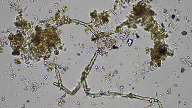 microorganisms and soil biology, with nematodes and fungi under the microscope. in a soil and compost sample