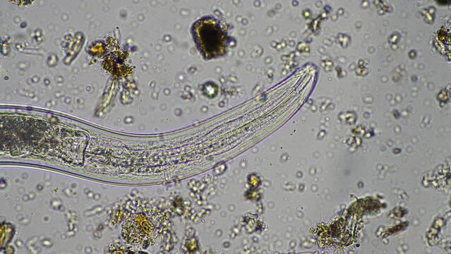 microorganisms and soil biology, with nematodes and fungi under the microscope