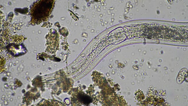 microorganisms and soil biology, with nematodes and fungi under the microscope
