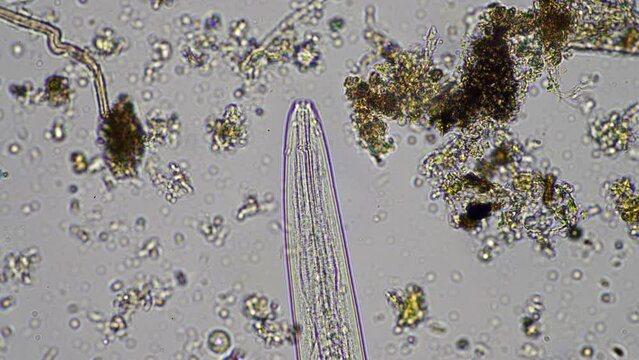 microorganisms and soil biology, with nematodes and fungi under the microscope. in a soil and compost sample