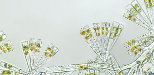 Licmophora sp. algae, marine and freshwater diatom under microscopic view. Genus of benthic,...