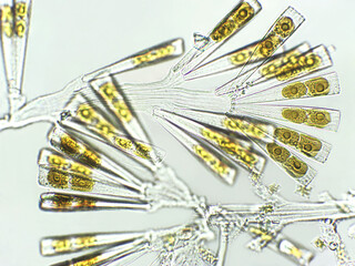 Licmophora sp. algae, marine and freshwater diatom under microscopic view. Genus of benthic,...