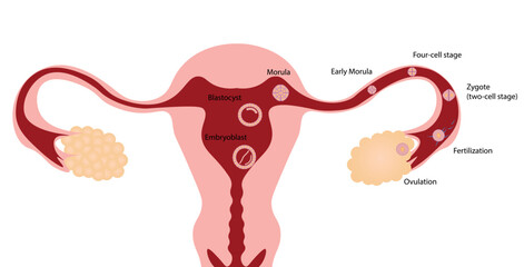 Fertilization steps illustration. Woman uterus close up showing fertilization steps.