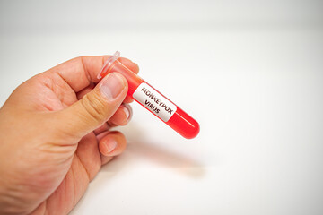 Close-up of  Blood sample tube positive with Monkeypox virus, new epidemic disease in 2022.