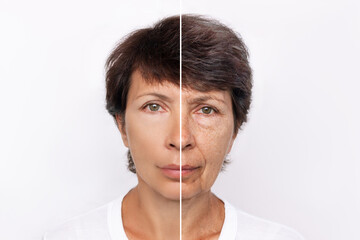 Comparison of young and aged woman's face. Youth, old age. The process of aging and rejuvenation,...