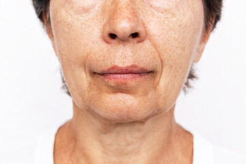 Lower part of elderly woman's face and neck with signs of skin aging isolated on a white...