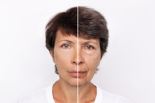 Comparison of young and aged woman's face. Youth, old age. The process of aging and rejuvenation, the result years later. Beauty treatments and lifting. Age-related changes, appearance of wrinkles