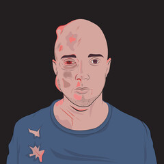 White man after an accident. Blows to the face and body.