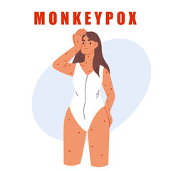 Monkeypox virus.Woman with rash and headache. Skin infections. Monkeypox virus infographic. Isolated vector illustration