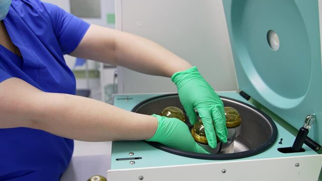 Equipment for getting plasma from blood sample. Nurse takes a test tube with red liquid from a reservoir in machine.