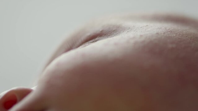  Macro shot of a sleeping childs face affected by diathesis. Troubled face skin of a small caucasian baby.   Cinematic footage of childs face with skin defect. Closeup footage of babies cheecks. 