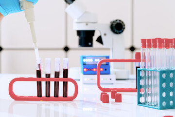 Blood test for hormones and microelements in a biochemical laboratory. Test tubes with blood in the hand of a laboratory assistant and a microscope on the background