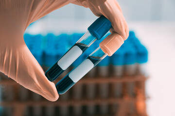 test tubes with a dark blue liquid in the hands of laboratory assistants in gloves