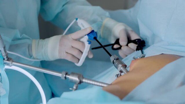 Hands of surgeons with the help of endoscopic equipment and instruments operate. performing laparoscopic surgery using endoscopic and laparoscopic instruments. laparoscopic instrument. 