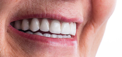 Obraz premium dental job photography, crowns veneers implants