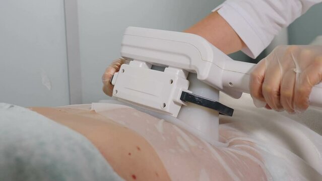 Body care procedure in beauty clinic. Fat overweight treatment. Woman getting cryolipolysis in professional cosmetic cabinet or spa center. Cryotherapy, Female patient lying on couch. 4 k video