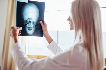 Female doctor examines x-ray of patients skull.