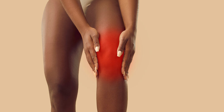 Young woman suffers from arthritis or leg injury, feels pain and touches her kneecap. Plus size black lady holding hands on highlighted red knee cap standing isolated on beige color text background