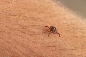 close-up deer tick trying to bite through human skin. Danger Infection through the bite of a dangerous insect that causes Borrelia disease.
